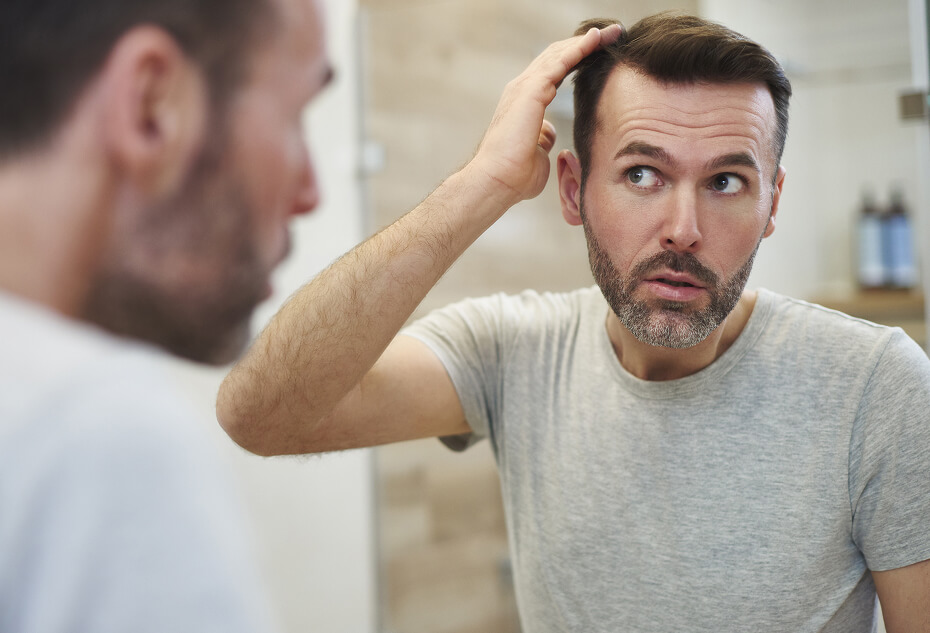 Finasteride